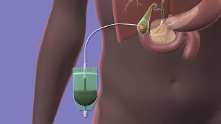 Bile Synthesis and Function [upl. by Deerc]