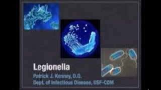 Legionella  Patrick Kenney MD [upl. by Eiramaneet]