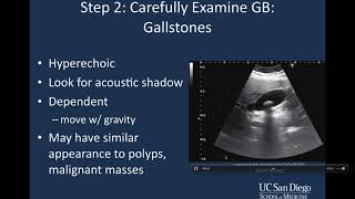 Bilirubin  Part 1 Metabolism amp Excretion [upl. by Clerk]