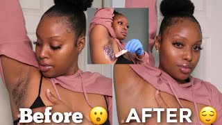 WAX Your Underarms AT HOME  How To Lighten Dark Underarms Naturally Detailed [upl. by Alexis]