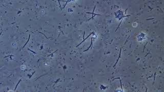 Bacteria of dental plaque under the microscope [upl. by Petie]