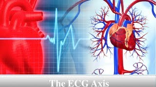 ECG Axis Tutorial Part 4  The Quadrant Method [upl. by Schach]