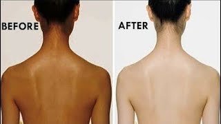 काली गर्दन को 5 मिनट में गोरा बना देंगा ये नुस्खा की देखकर चुप रह जाओगेDark NeckBest Beauty Tips [upl. by Honan]