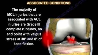 Medial Collateral Ligament injury  MCL Injuries  Everything You Need To Know  Dr Nabil Ebraheim [upl. by Terrag]