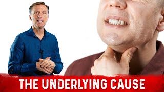 How to naturally heal your esophagus from acid reflux damage [upl. by Oalsecnew612]