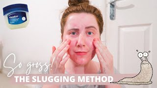 I Tried SLUGGING For A Week With ACNE Prone Skin [upl. by Olaf243]