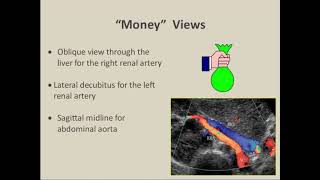 Renal Doppler Ultrasound Basics [upl. by Freedman]