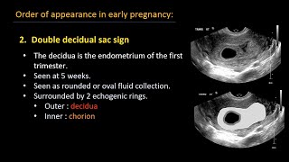 Ultrasound of normal early pregnancy [upl. by Felice669]