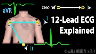 12 Lead ECG Explained Animation [upl. by Alahs53]