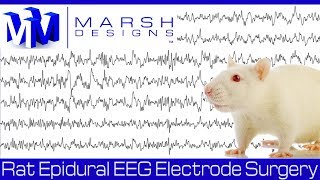 Learn to Read EEGs Part 1 [upl. by Chaworth]