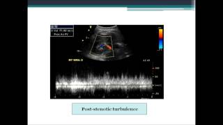 Renal Arteries From Start to Finish [upl. by Eednarb]