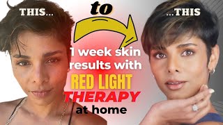 How to Improve Benefits of RED LIGHT THERAPY for Skin [upl. by Aigil]