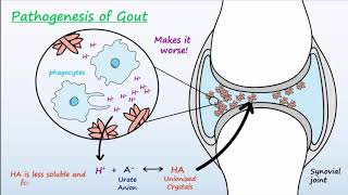 Gout  Mechanisms amp Treatment [upl. by Inamik]