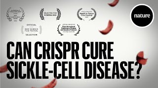 Can CRISPR cure Sicklecell Disease [upl. by Namus83]