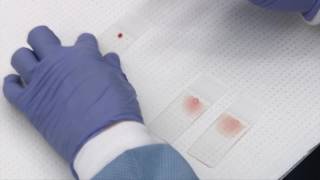 Making and staining blood smears [upl. by Sophronia]