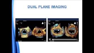 Echo BachelorClass  Your introduction to basic echocardiography [upl. by Sinaj]