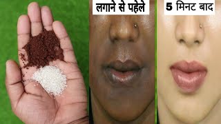 5 मिनट में चेहरा साफ और गोरा करने का घरेलू उपाय  Skin Whitening  Gora hone ka tarika [upl. by Vitkun]