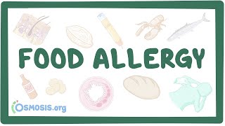 Food allergy  an Osmosis Preview [upl. by Atem502]