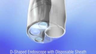 EndoSheath® Cystoscopy [upl. by Aihsal648]