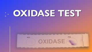 Oxidase Test [upl. by Maya]