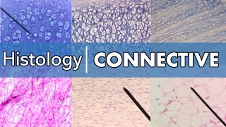 Histology  Connective Tissue [upl. by Sparks672]