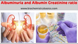 Albuminuria  Albumin Creatinine Ratio  Albumin In Urine [upl. by Ming533]