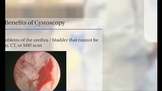 Cystoscopy Video Presentation [upl. by Esiuole]