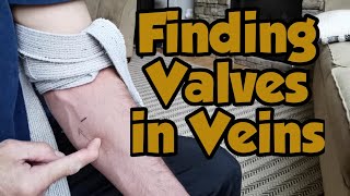 Finding Valves in Veins [upl. by Atteras]