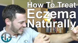 How To Treat Eczema Naturally [upl. by Bellina611]