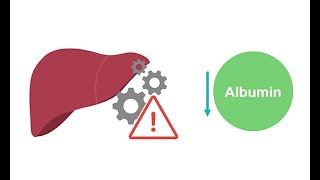 Getting to know albumin physiology [upl. by Annahsohs33]