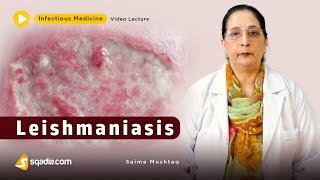 Leishmaniasis  Infectious Clinical Medicine Video  VLearning  sqadiacom [upl. by Carola]