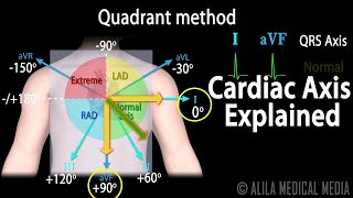 Cardiac Axis Interpretation Animation [upl. by Melissa]