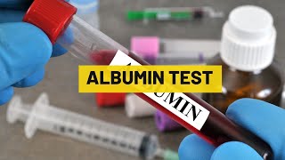 Albumin Test  My Lab Solution [upl. by Chipman987]