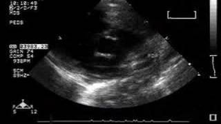 Fetal Circulation  Embryology [upl. by Nnov719]